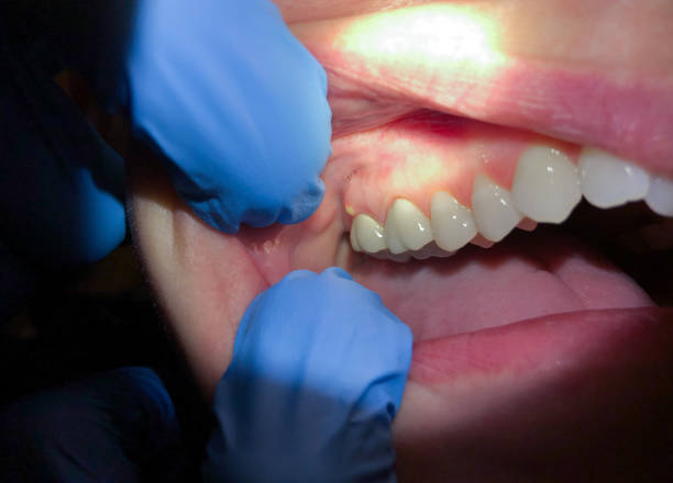 Best Orthodontic Emergency Dentist in Rosenhayn, NJ