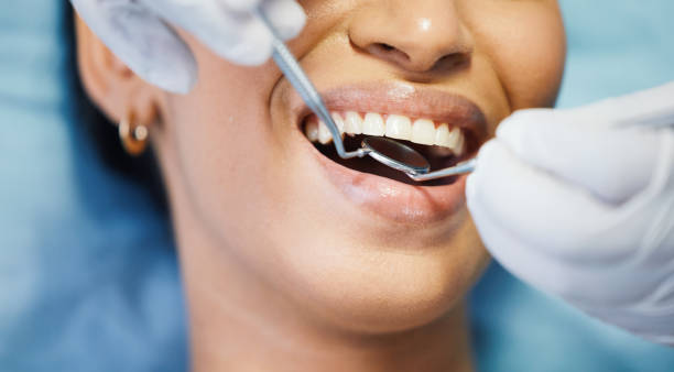 Best Emergency Dentist for Lost Fillings or Crowns in Rosenhayn, NJ